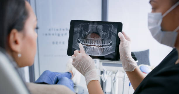Licensed Tooth Extraction service in Hillsboro, OR - Smile Center Dentistry